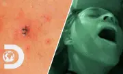 Извадиха кърлежи от вагината и пениса на двойка, правила секс на площад в Новосибирск